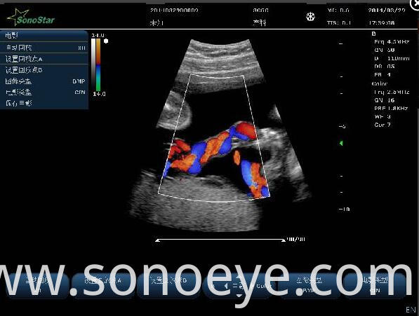 C10 Color Doppler Ultrasound System For Hostipal